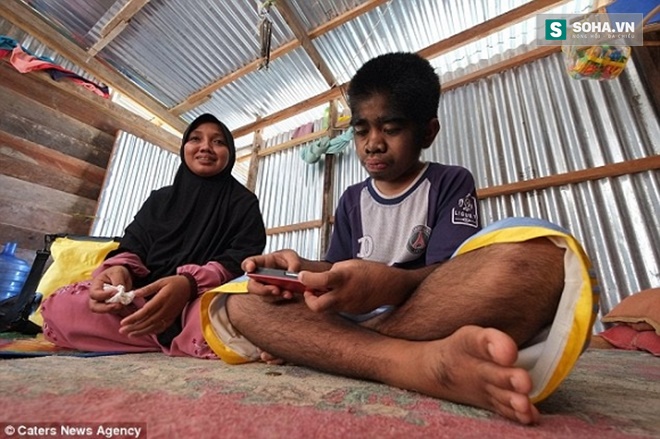  Hirsute đang sống cùng mẹ và 4 anh chị em ở làng Mamburung, Bắc Kalimantan, đảo Borneo, Indonesia. 