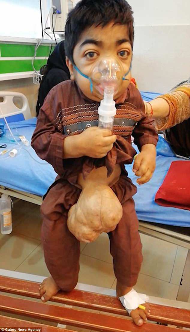 Salman Qadir is desperately waiting for surgery to remove a hernia from his belly button that is almost the size of two cricket balls. The growth has left him unable to walk properly 